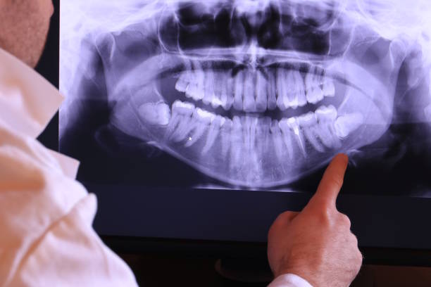 Best Emergency Treatment for Toothache in Moline, IL
