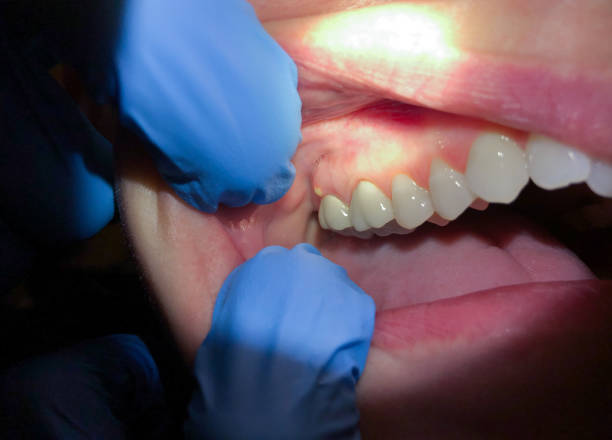 Best Emergency Dental Care for Trauma or Injury in Moline, IL