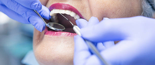 Best Emergency Tooth Extraction in Moline, IL